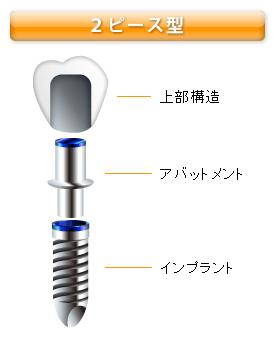 ２ピース型